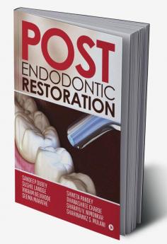 POST ENDODONTIC RESTORATION