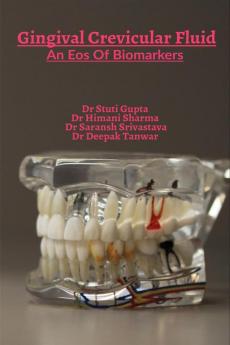 Gingival Crevicular Fluid:An Eos Of Biomarkers : Role of GCF in Diagnosis and Prognosis Of Periodontal Diseases