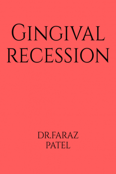 Gingival Recession