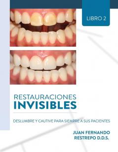 Restauraciones Invisibles
