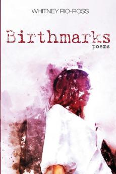 Birthmarks