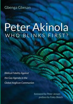 Peter Akinola: Who Blinks First?