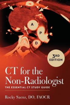 CT for the Non-Radiologist