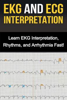 EKG and ECG Interpretation: Learn EKG Interpretation Rhythms and Arrhythmia Fast!