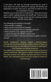 Cupping Therapy