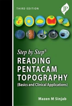 STEP BY STEP READING PENTACAM TOPOGRAPHY (BASICS AND CLINICAL APPLICATIONS)
