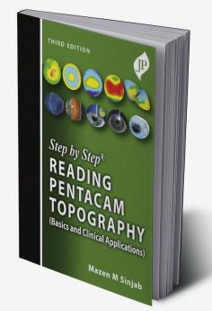 STEP BY STEP READING PENTACAM TOPOGRAPHY (BASICS AND CLINICAL APPLICATIONS)