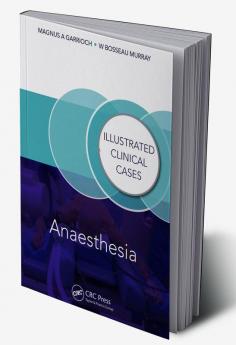 Anaesthesia