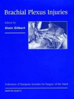 Brachial Plexus Injuries