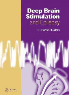 Deep Brain Stimulation and Epilepsy