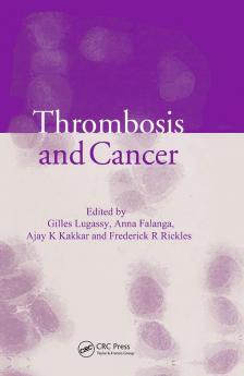 Thrombosis and Cancer