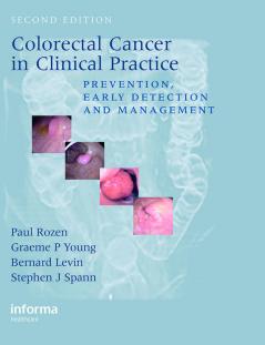 Colorectal Cancer in Clinical Practice