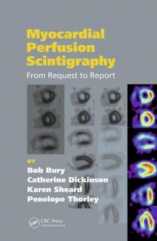 Myocardial Perfusion Scintigraphy