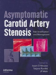 Asymptomatic Carotid Artery Stenosis