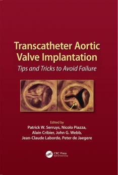 Transcatheter Aortic Valve Implantation