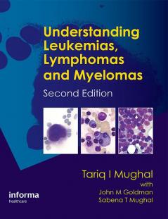 Understanding Leukemias Lymphomas and Myelomas