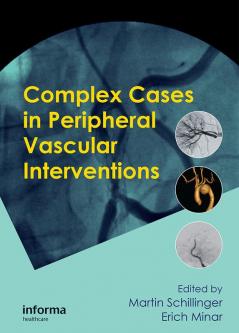 Complex Cases in Peripheral Vascular Interventions