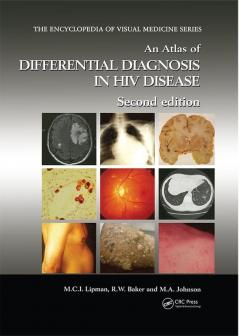 Atlas of Differential Diagnosis in HIV Disease