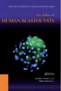 Atlas of Human Blastocysts