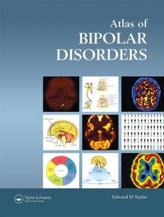 Atlas of Bipolar Disorders