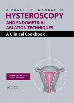 Practical Manual of Hysteroscopy and Endometrial Ablation Techniques