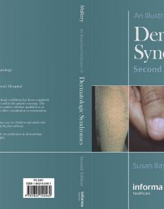Illustrated Dictionary of Dermatologic Syndromes