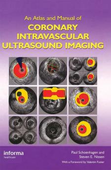 Atlas and Manual of Coronary Intravascular Ultrasound Imaging