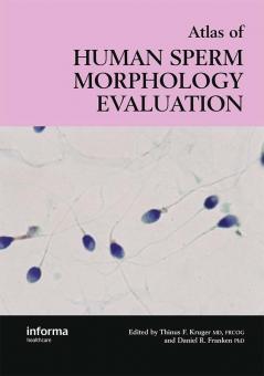 Atlas of Human Sperm Morphology Evaluation