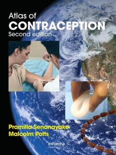Atlas of Contraception