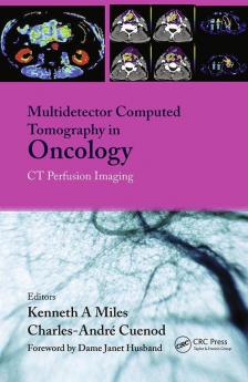 Multi-Detector Computed Tomography in Oncology