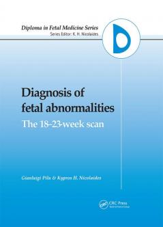 Diagnosis of Fetal Abnormalities