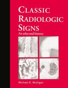 Classic Radiologic Signs