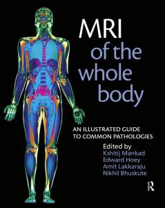 MRI of the Whole Body