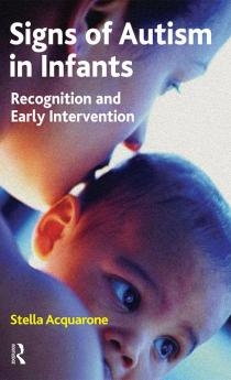Signs of Autism in Infants
