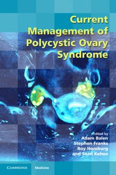 Current Management of Polycystic Ovary Syndrome
