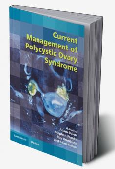 Current Management of Polycystic Ovary Syndrome