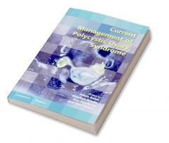 Current Management of Polycystic Ovary Syndrome