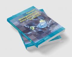 Current Management of Polycystic Ovary Syndrome