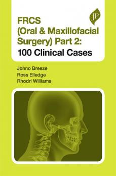 FRCS (ORAL & MAXILLOFACIAL SURGERY) PART 2: 100 CLINICAL CASES