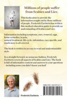 Scabies and Lice Explained. Causes Prevention Treatment and Remedies All Covered! Information Including Symptoms Removal Eggs Home Remedies in