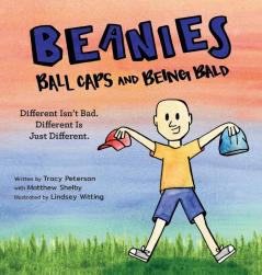 Beanies Ball Caps and Being Bald