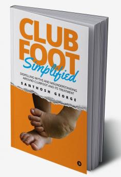 Clubfoot Simplified Dispelling Myths and Misunderstanding around Clubfoot and its treatment