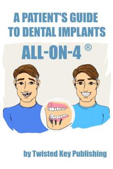 A Patient's Guide to Dental Implants: All-on-4: 1