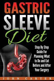 Gastric Sleeve Diet: Step By Step Guide For Planning What to Do and Eat Before and After Your Surgery: 2