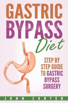 Gastric Bypass Diet: Step By Step Guide to Gastric Bypass Surgery: 2 (Bariatric Cookbook)