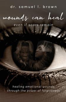 Wounds Can Heal Even If Scars Remain