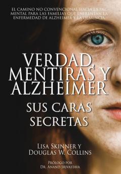 Verdad Mentiras y Alzheimer
