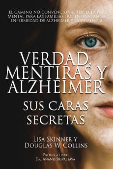 Verdad Mentiras y Alzheimer
