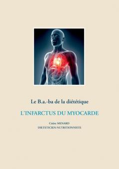 Le B.a.-ba de la diététique après un infarctus du myocarde