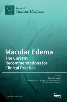 Macular Edema